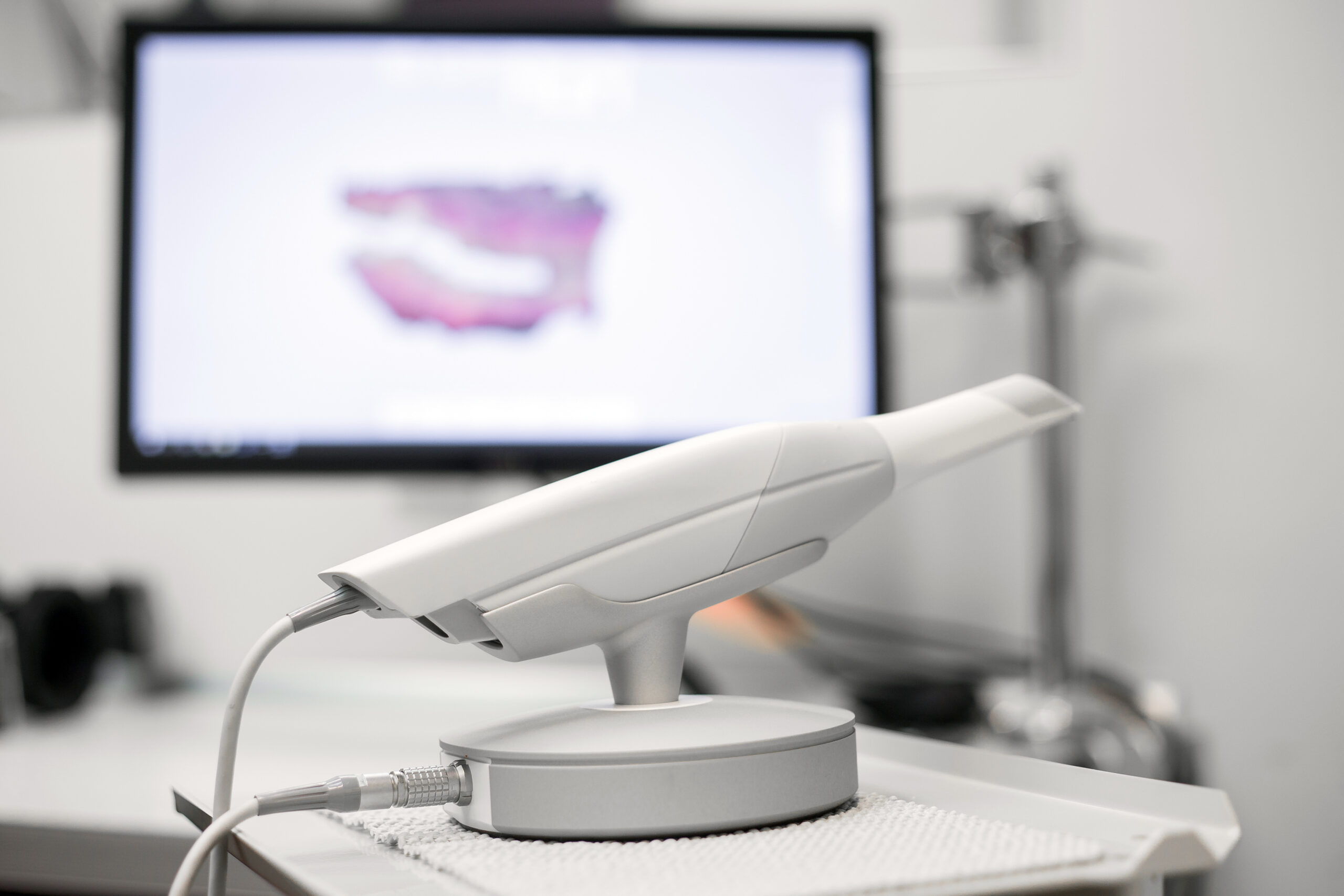 An iTero intraoral scanner in its cradle, with a 3D scan of the teeth on the monitor behind it