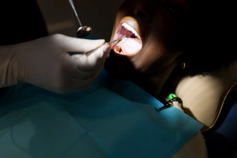 A gloved hand retracting a patient's lip with a mirror during treatment