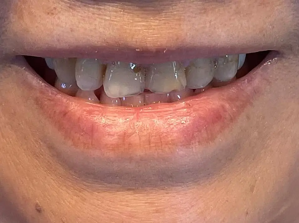 precision dental care case 02 before 2