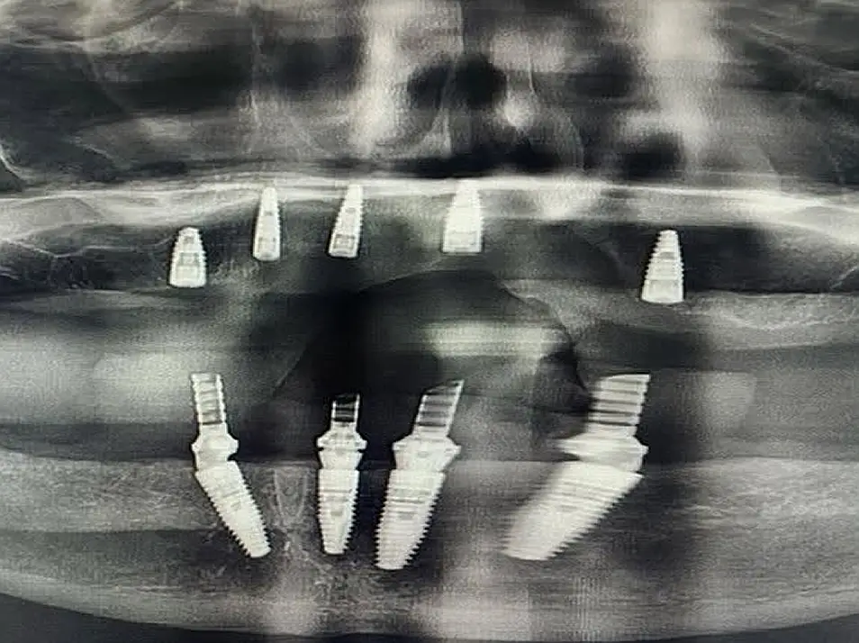 precision dental care case 10 01