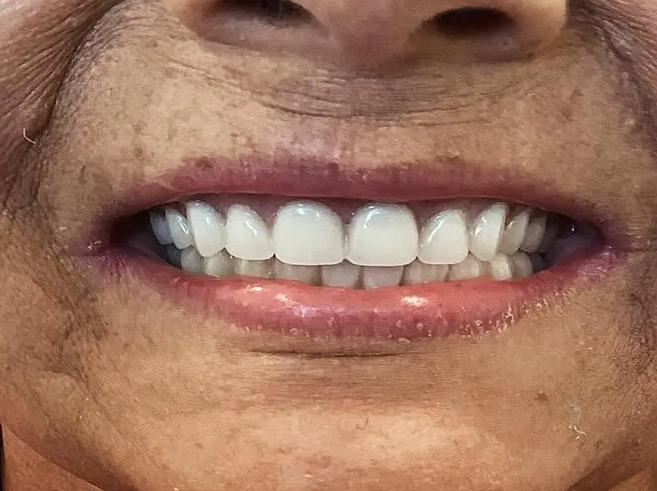 precision dental care case 10 02