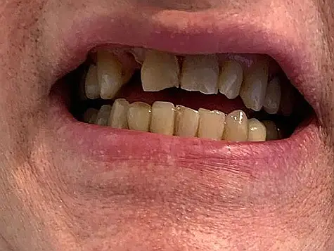 precision dental care case 3 01
