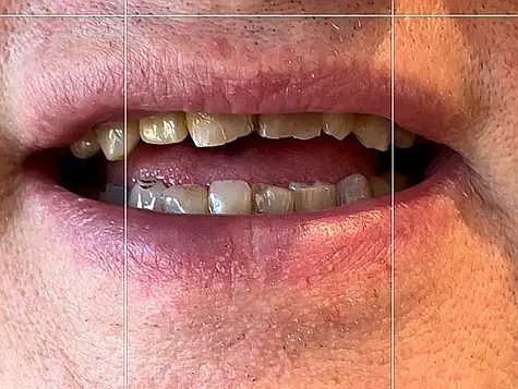precision dental care case 3 02