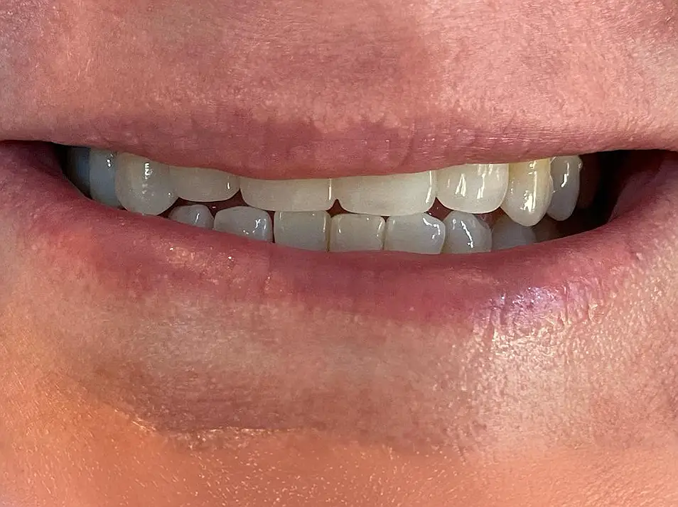 precision dental care case 4 02