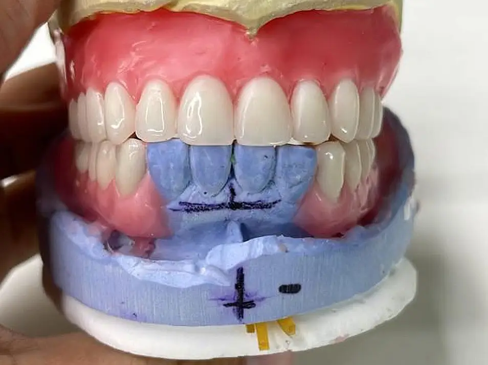 precision dental care case 5 01