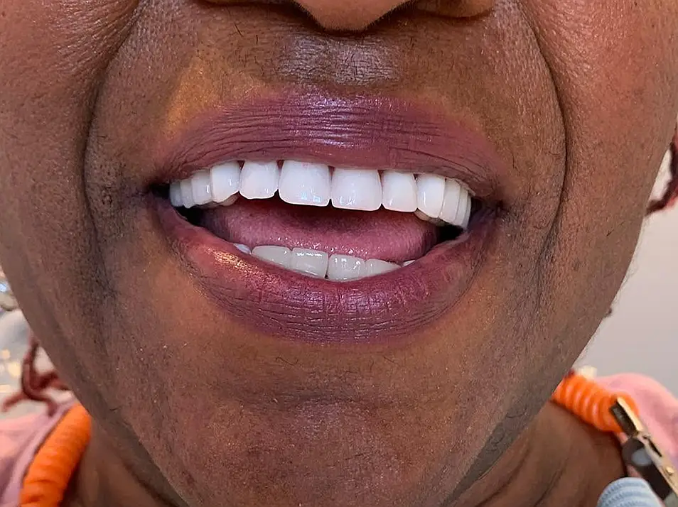 precision dental care case 5 02