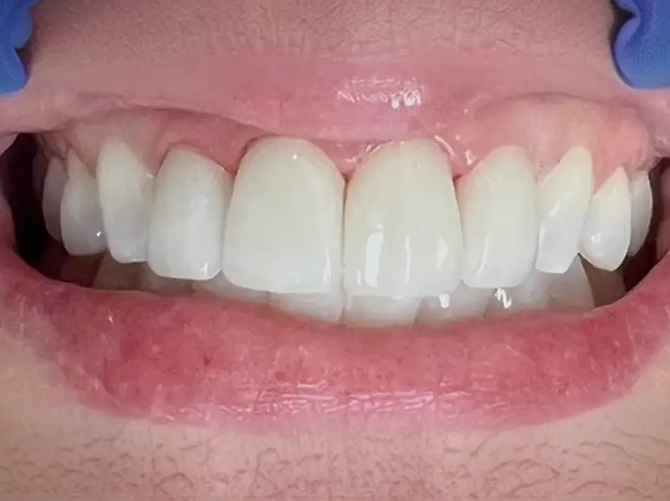 precision dental care case 6 02