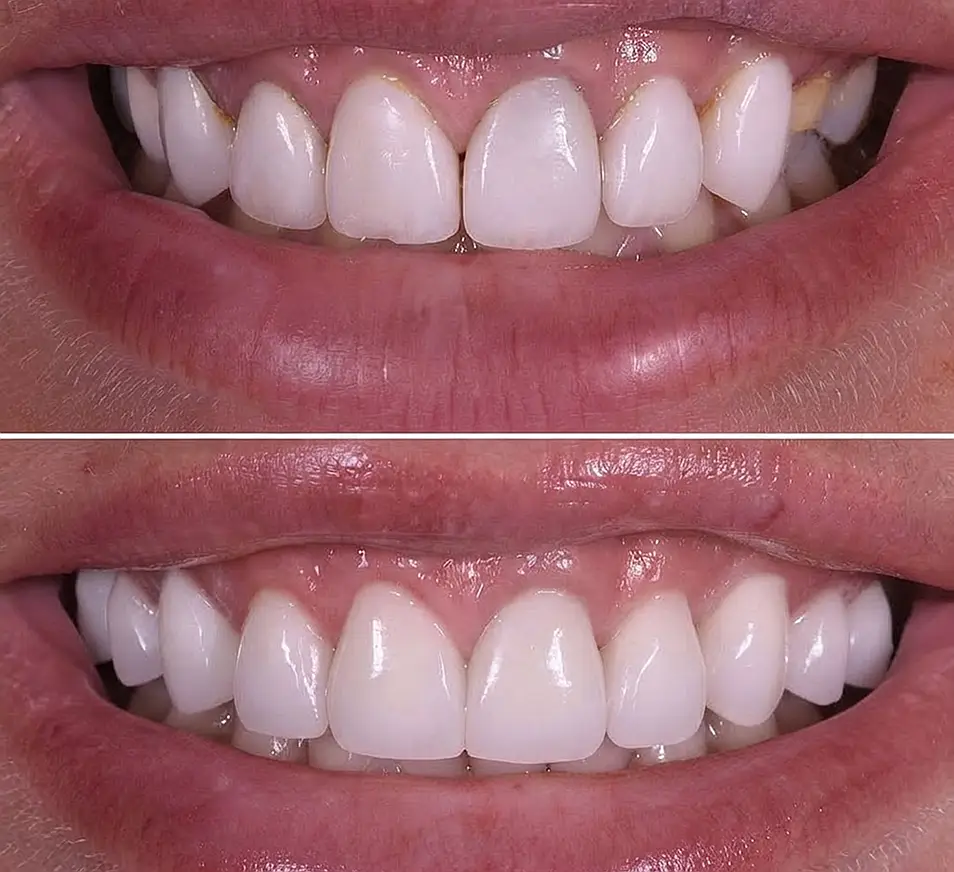 precision dental care case 8 01