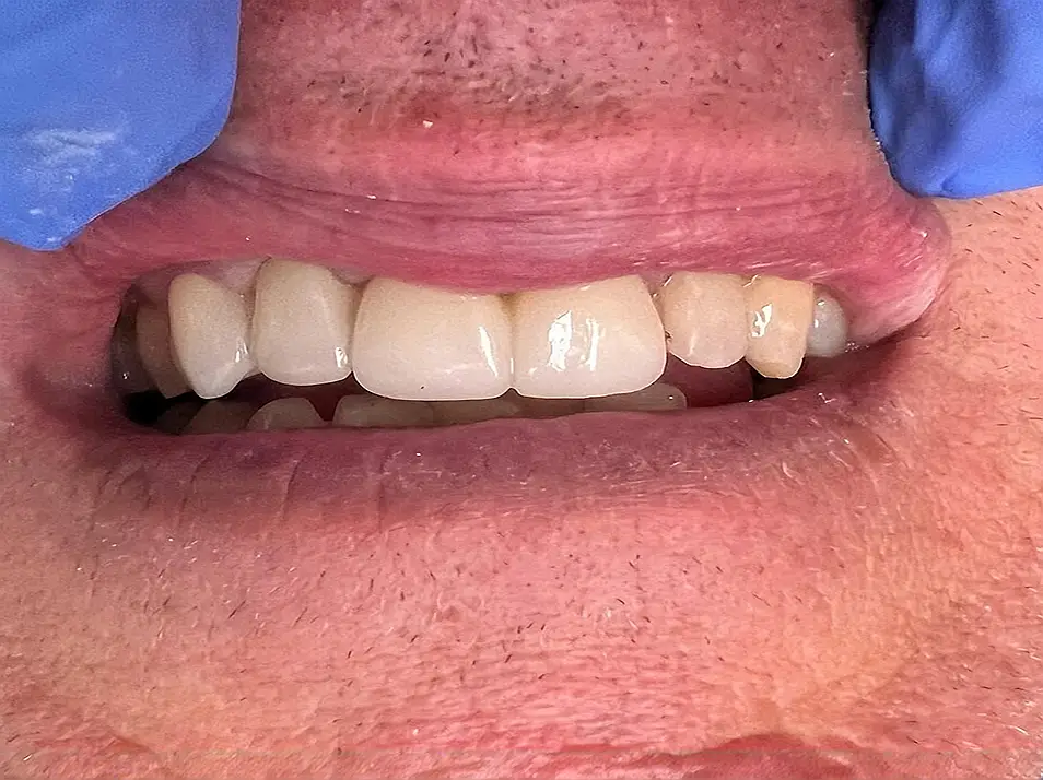 precision dental care case 9 02